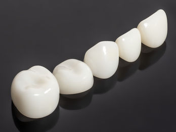 Pediatric zirconia crown Mix