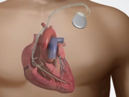 Devabulator  Crack  License Key Full Free Download [32|64bit] (April-2022)