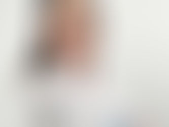 Opinião - Viver com Doença Venosa Crónica no Verão