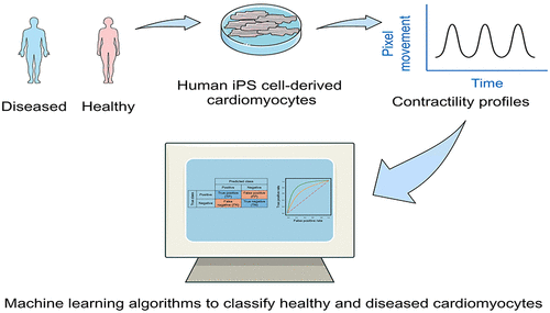 Machine Learning Techniques to Classify Healthy and Diseased Cardiomyocytes by Contractility Profile