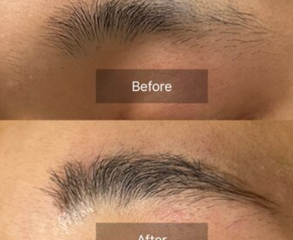 ハリウッドブロウリフトで理想の眉毛を実現！