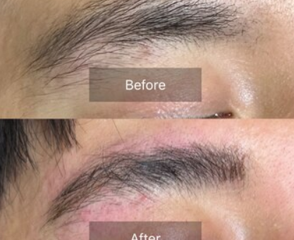 ハリウッドブロウリフトで理想の眉毛を実現！