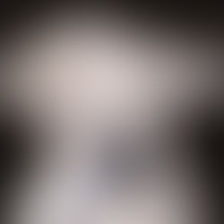 Bald figure with white skin holds head, surrounded by cloud-like smoke against a dark background. The mood appears contemplative.