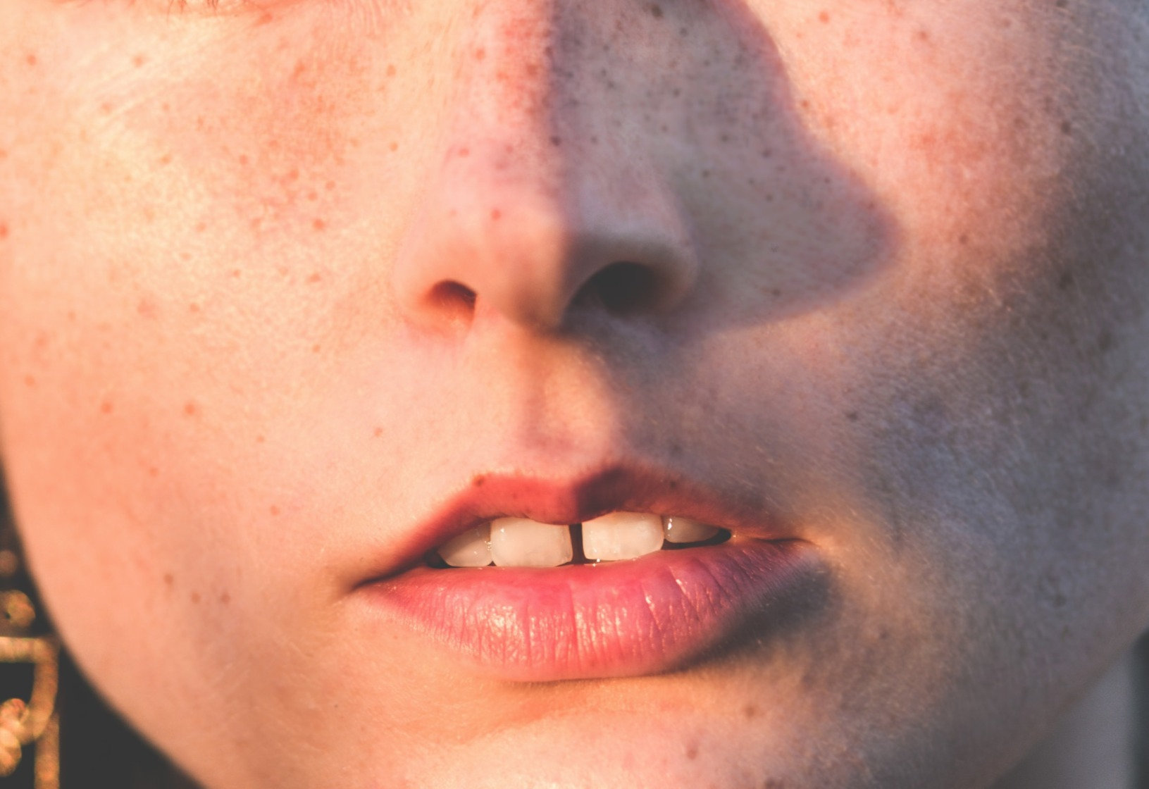 FACIAL HAIR BLEACH REJUVENATION