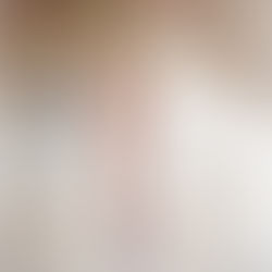 Life Without Limbs: Apotemnophilia