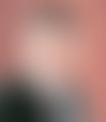 생명보험의 개런티와 논개런티