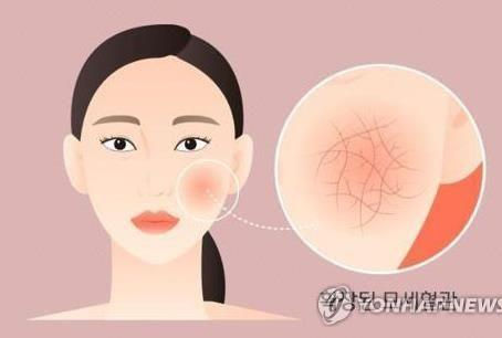 '갱년기 장애 심하면 심뇌혈관 질환 위험↑'
