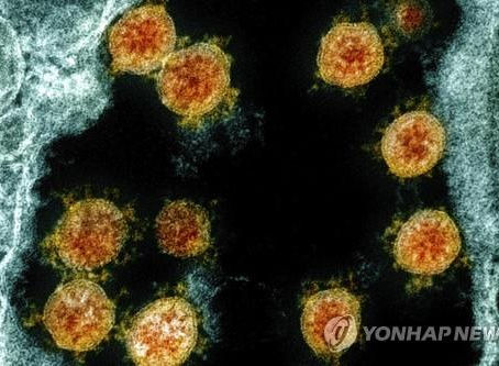 미국서도 코로나 재감염 사례…25세 남성 재감염때 증상 더 심각