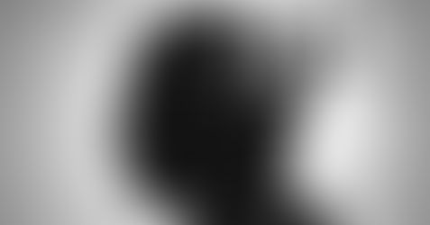 치매 관련 뇌 변화, 여성이 남성보다 일찍 나타난다"