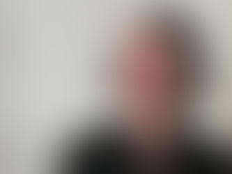 거식증, 언니의 죽음..개인의 고통 넘어선 노벨문학상 시인