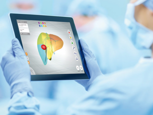 A Novel App to Assist Liver Surgery