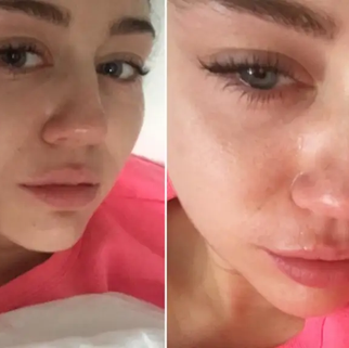 Aseguran que Miley Cyrus enfrenta dolorosa crisis de salud