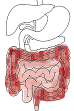 腸炎症.png