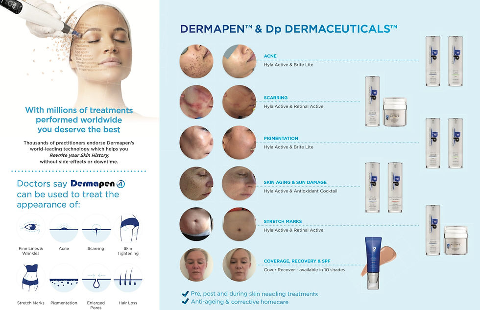dermapen treatment in hong kong