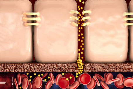 Is your gut barrier compromised? 6 signs to watch for.