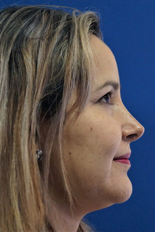 WhatsApp Image 2022-09-26 at 5.29.48 PM (15).jpeg