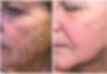 BT-BEFOREANDAFTER-ALL-REV030821_Page_21_800x (kopia).jpg