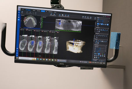 WHAT'S A CBCT SCAN - AND WHY IS IT FREE FOR NEW PATIENTS?
