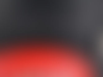 Post Concussion Challenges