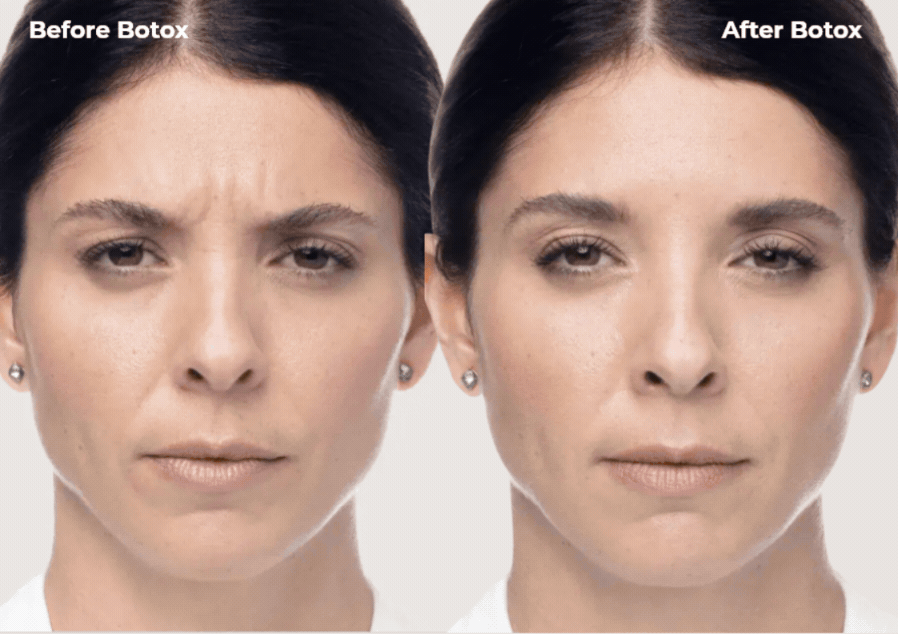 EverGlow Med Spa before and after