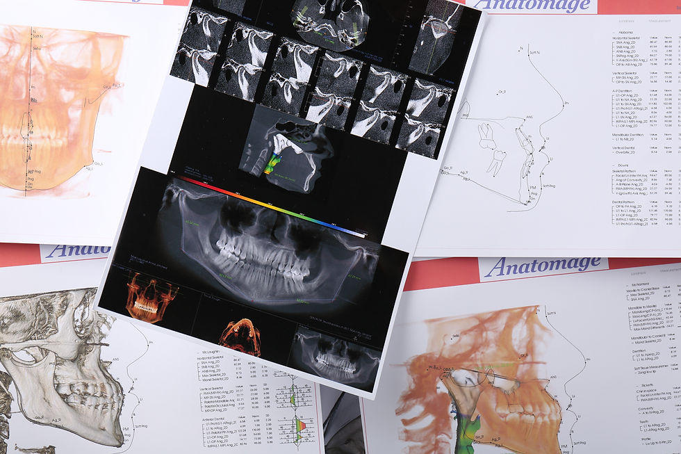 Dientes en mal estado, caries, rotos, sangrado de encías