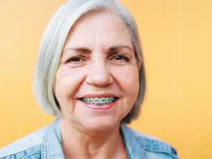 Ortodoncia en Adultos