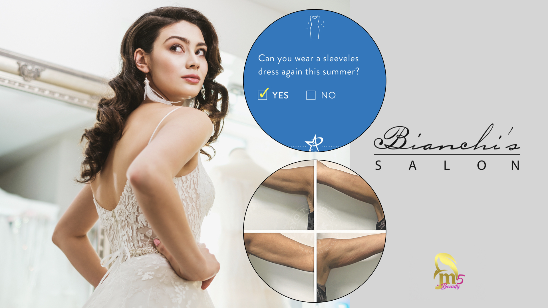 GET YOUR ARMS IN SHAPE FOR YOUR WEDDING DAY content media