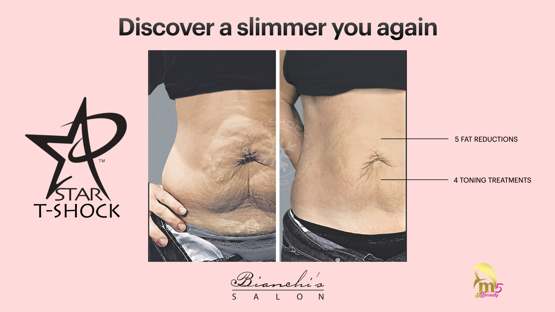 Discover a slimmer you again content media