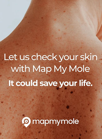 Map-My-Mole-2_edited.jpg