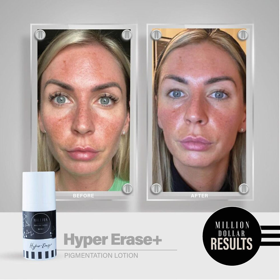 Thumbnail: Medi+ Hyper Erase+ – 30ml