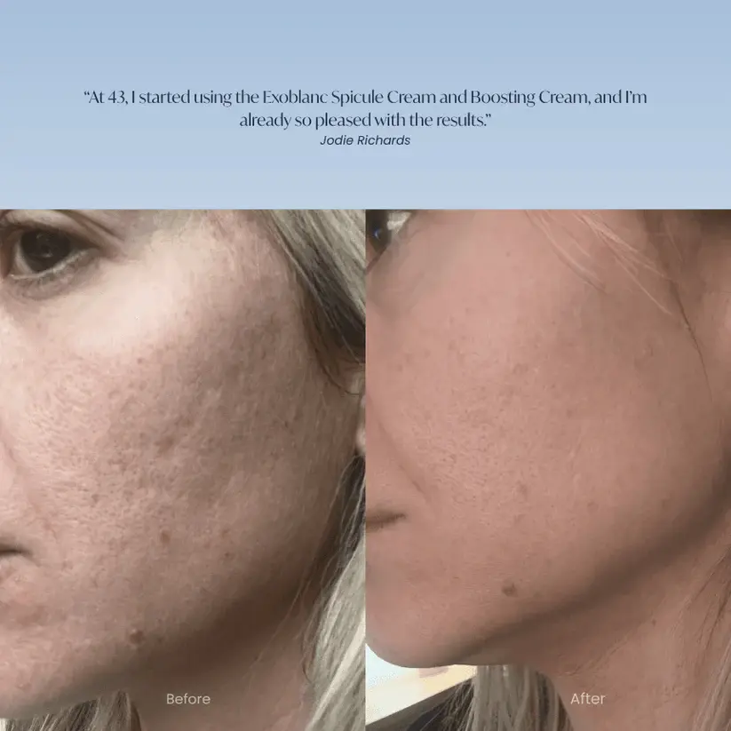 Thumbnail: Liquid Microneedling Spicule Cream