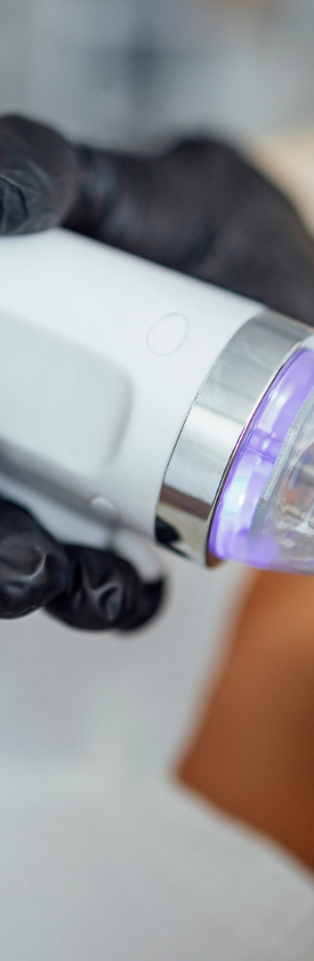 microneedling radiofrequence biotyparis