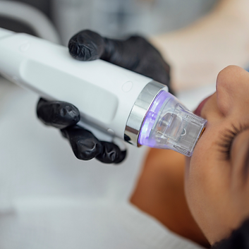 microneedling radiofrequence biotyparis