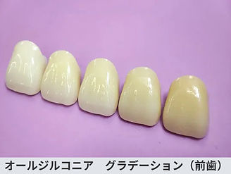 オールジルコニアグラデーション(前歯)