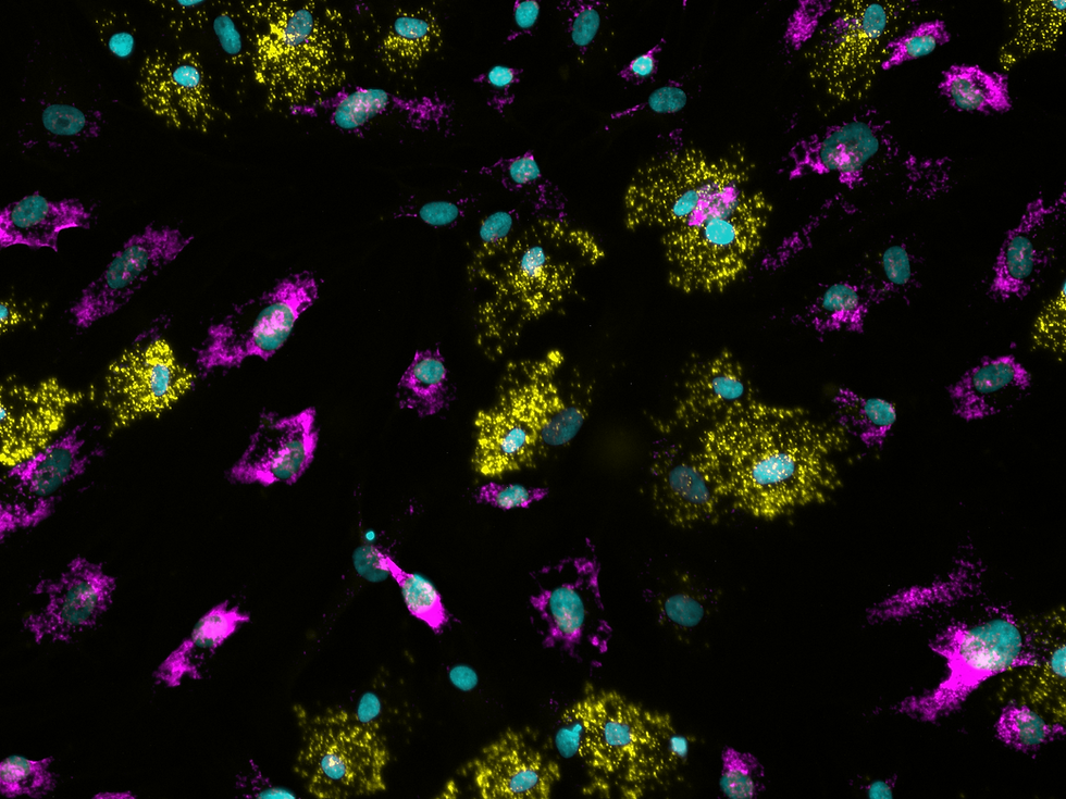 FISH on human brown adipocytes