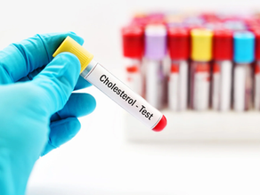 Cholesterol and Artery Plaque Buildup