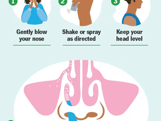 How To Correctly Use Nasal Spray