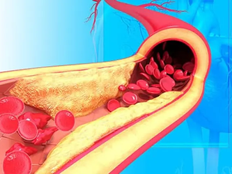 What High Blood Pressure Can Do to Your Body