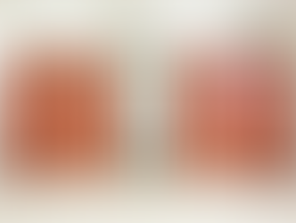 Are You Peeing Too Often? Here's What Urologists Say Is Normal