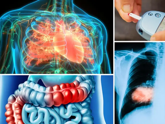Everyday Habits to Ease Inflammation