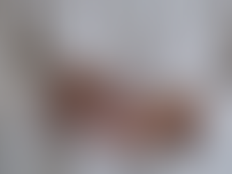 5 Potential Serious Side Effects of Magnesium Supplement