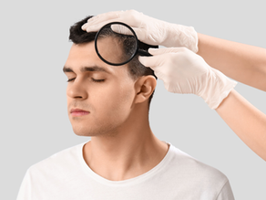 Dandruff: What Your Scalp Is Trying to Tell You