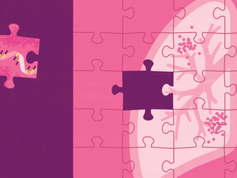 5 Surprising Signs of an Infection in Older Adults