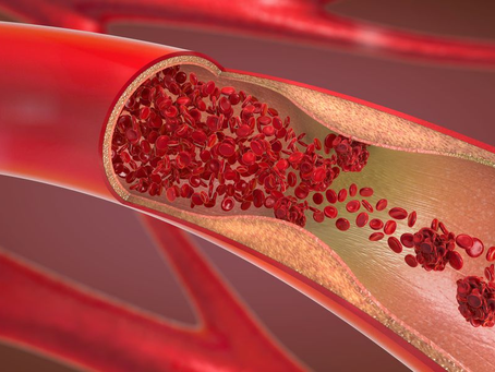 What Does a Blood Clot Feel Like? 8 Signs You Should Never Ignore