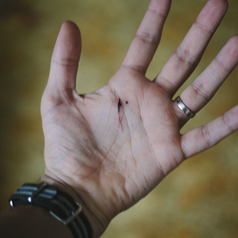 How to Tell If Your Cut Is Infected