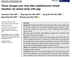 9 Tissue Changes Over Time After PDO Thread Insertion