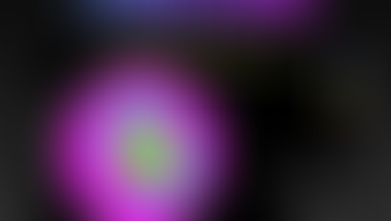 Longitudinal Displacement - Speckle Tracking