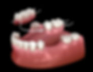 Orlando Partial Dentures.jpeg