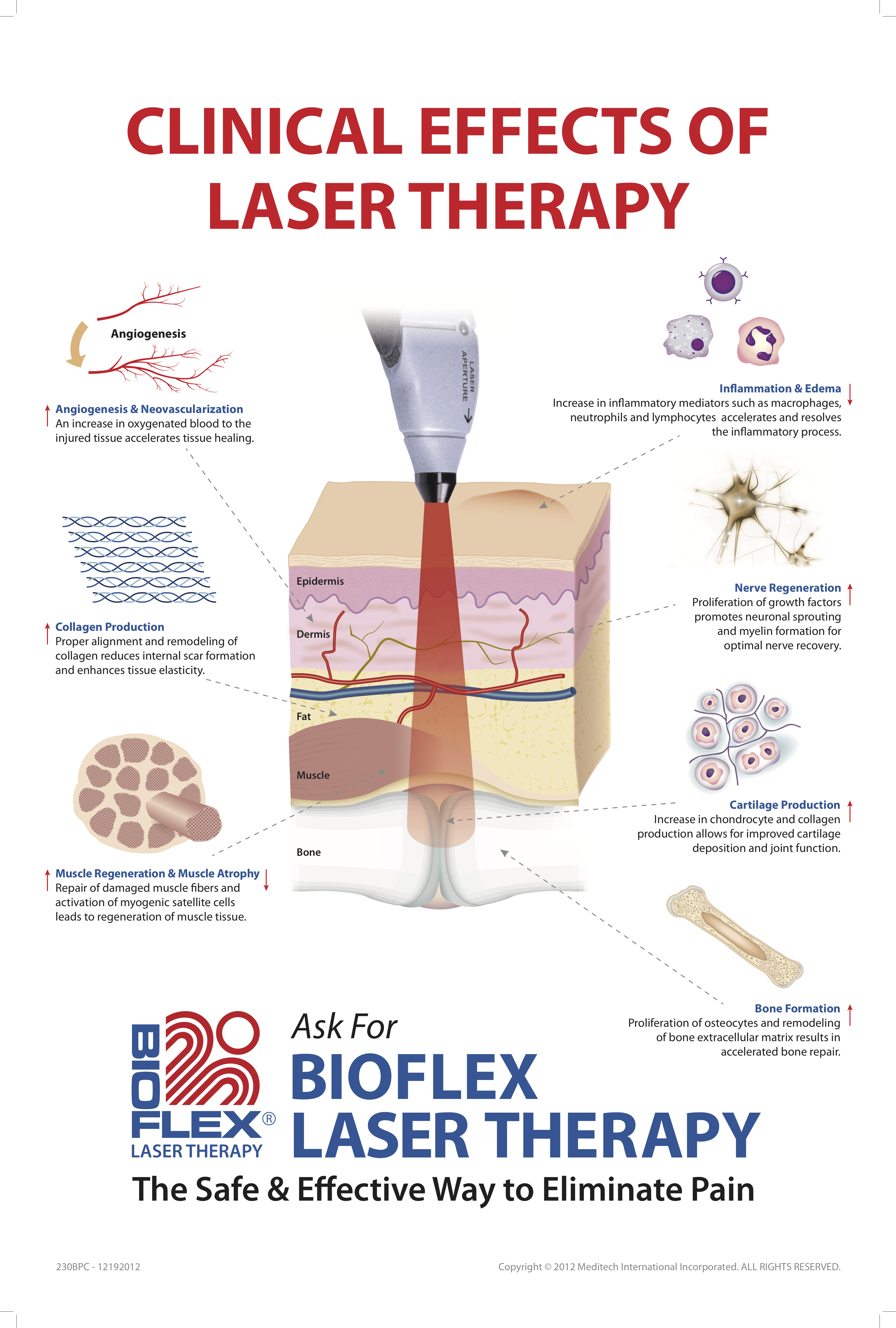 BioFlex Laser | Pure Balance Osteopathy