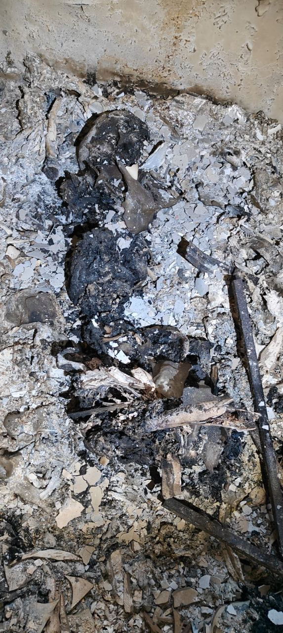 The burnt body of a child